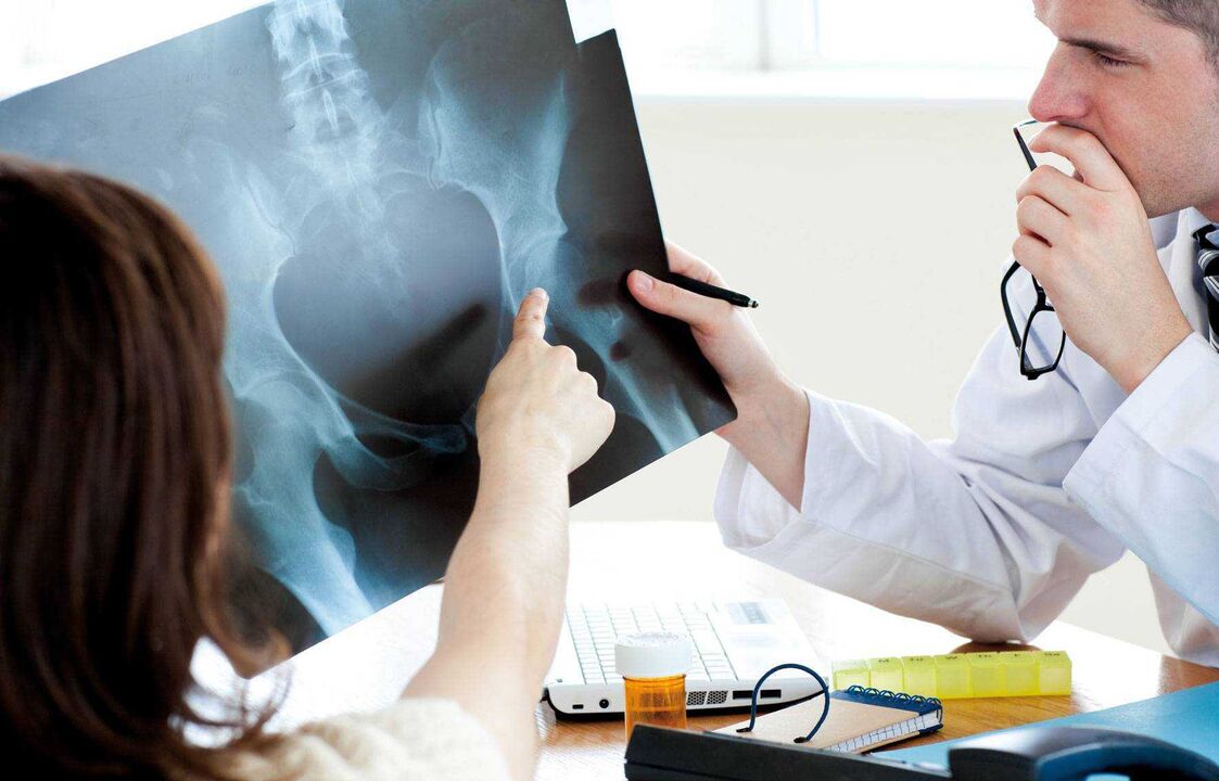 Dokteren ënnersicht Röntgen fir Hip Arthrosis