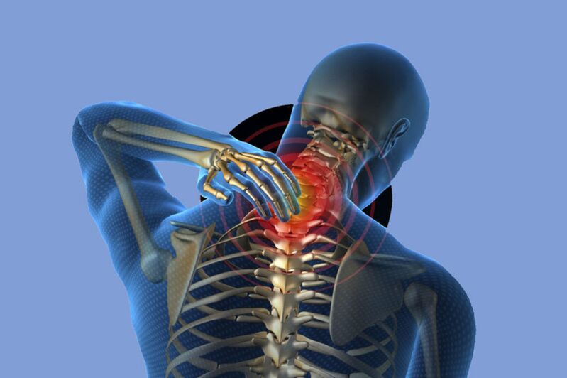 Hals Schmerz mat Osteochondrose